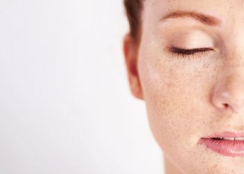 بهترین کرم های ضد لک هورمونی